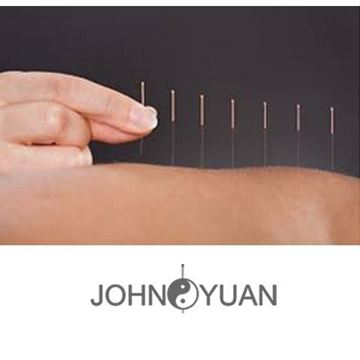 Picture of John Yuan Acupuncture Good Health Centre - $120 Voucher